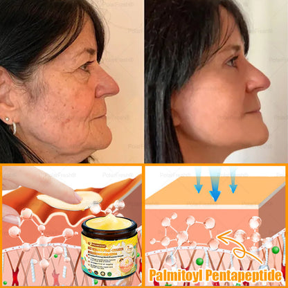 🗽Made & Shipped from USA | Clinically Proven: PolarFresh® Bee Venom Comprehensive Cream with bee venom peptides, botulinum toxin, hyaluronic acid, and collagen💧. Targets wrinkles, fine lines, sagging, stretch marks, dark spots and more