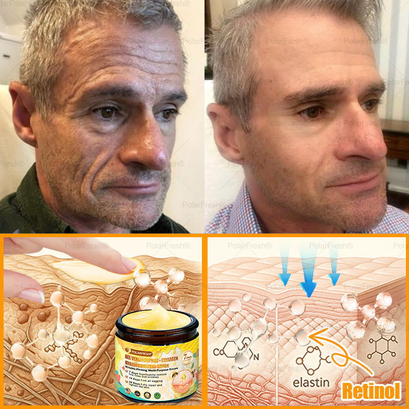 🗽Made & Shipped from USA | Clinically Proven: PolarFresh® Bee Venom Comprehensive Cream with bee venom peptides, botulinum toxin, hyaluronic acid, and collagen💧. Targets wrinkles, fine lines, sagging, stretch marks, dark spots and more