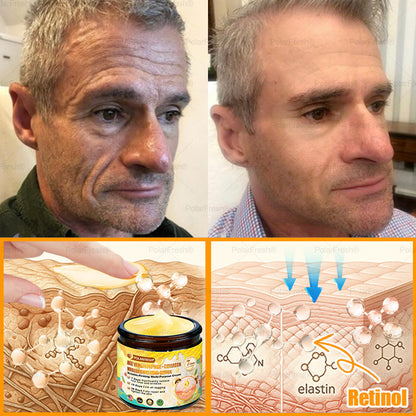 🗽Made & Shipped from USA | Clinically Proven: PolarFresh® Bee Venom Comprehensive Cream with bee venom peptides, botulinum toxin, hyaluronic acid, and collagen💧. Targets wrinkles, fine lines, sagging, stretch marks, dark spots and more