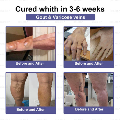 CareUplift® Joint Restore Plus 🎉🎉