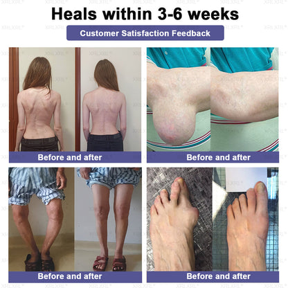 CareUplift® Joint Restore Plus 🎉🎉