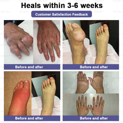 CareUplift® Joint Restore Plus 🎉🎉