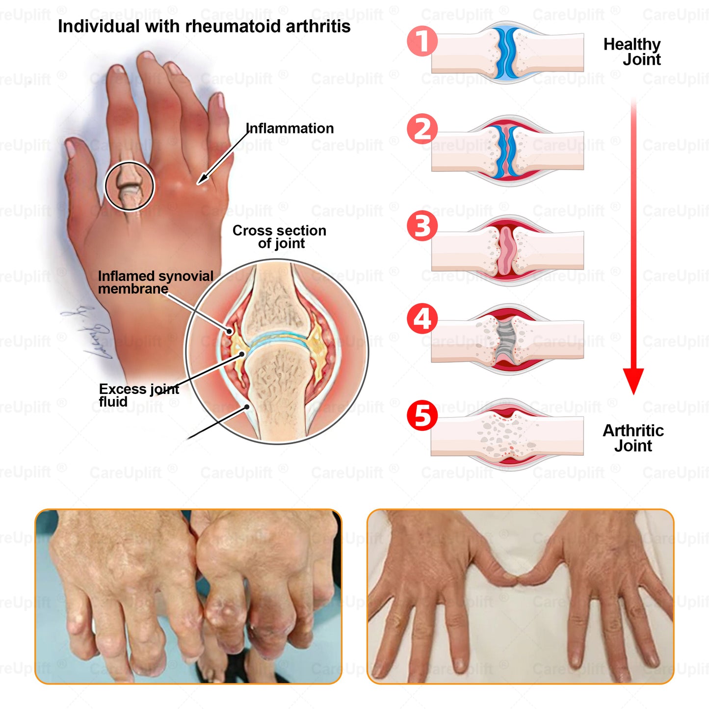 CareUplift® Joint Restore Plus 🎉🎉(Specially for older adults)
