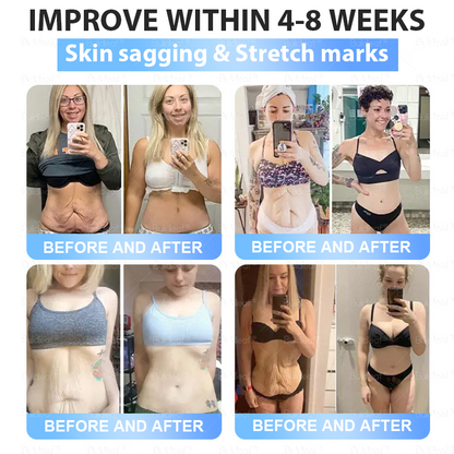 C US 🏥FDA Store | 𝐵uil𝗱𝐿ea𝐟® 𝑺𝑀𝗚T-𝑮𝐋𝑃-1 𝐒limming & 𝐻ealth 𝑁ano 𝑀icroneedle 𝑃atch with Collagen & Matrixyl 3000 丨Obesity,Cardiovascular Diseas, Diabetes, Sleep Apnea, Joint Problems and More