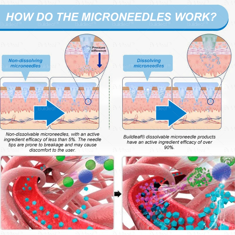 C US 🏥FDA Store | 𝐵uil𝗱𝐿ea𝐟® 𝑺𝑀𝗚T-𝑮𝐋𝑃-1 𝐒limming & 𝐻ealth 𝑁ano 𝑀icroneedle 𝑃atch with Collagen & Matrixyl 3000 丨Obesity,Cardiovascular Diseas, Diabetes, Sleep Apnea, Joint Problems and More