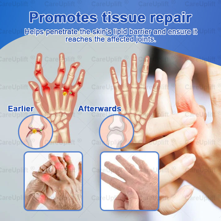 CareUplift® Joint Restore Plus 🎉🎉