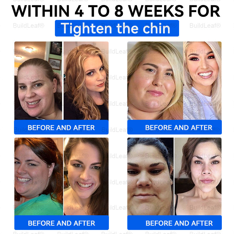 Official Store | BuildLeaf® SMGT-GLP-1 Nano Microneedle Patch with Collagen & Matrixyl 3000 丨Obesity,Cardiovascular Diseas, Diabetes, Sleep Apnea, Joint Problems and More