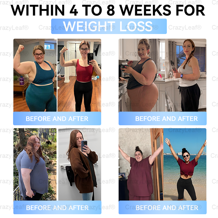 C US 🏥FDA Store | 𝐵uil𝗱𝐿ea𝐟® 𝑺𝑀𝗚T-𝑮𝐋𝑃-1 𝐒limming & 𝐻ealth 𝑁ano 𝑀icroneedle 𝑃atch with Collagen & Matrixyl 3000 丨Obesity,Cardiovascular Diseas, Diabetes, Sleep Apnea, Joint Problems and More