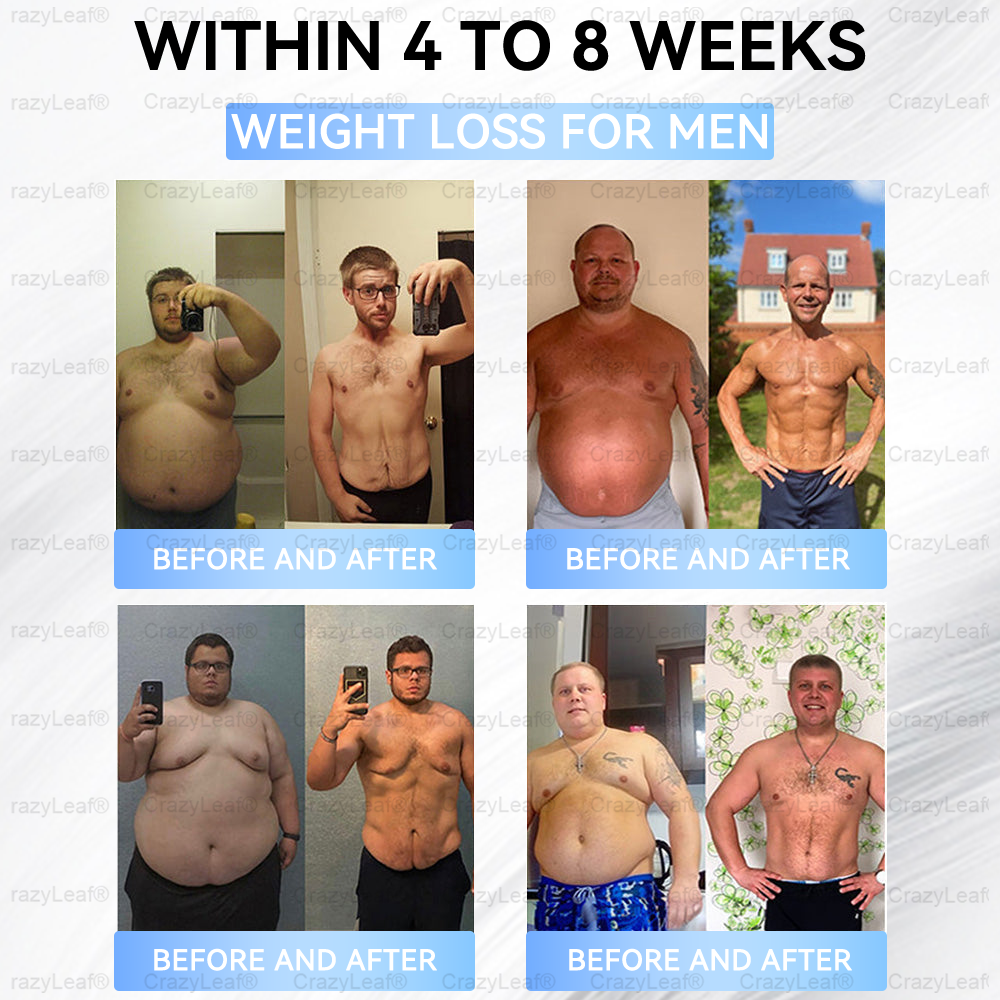 C US 🏥FDA Store | 𝐵uil𝗱𝐿ea𝐟® 𝑺𝑀𝗚T-𝑮𝐋𝑃-1 𝐒limming & 𝐻ealth 𝑁ano 𝑀icroneedle 𝑃atch with Collagen & Matrixyl 3000 丨Obesity,Cardiovascular Diseas, Diabetes, Sleep Apnea, Joint Problems and More