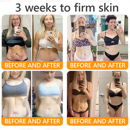 🗽Made & Shipped from USA | Clinically Proven: PolarFresh® Bee Venom Comprehensive Cream with bee venom peptides, botulinum toxin, hyaluronic acid, and collagen💧. Targets wrinkles, fine lines, sagging, stretch marks, dark spots and more