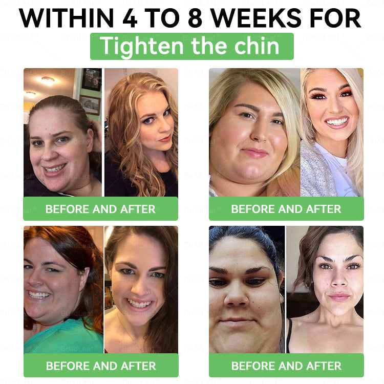 US 𝖮𝖿𝖿𝗂𝖼𝗂𝖺𝗅 𝖲𝗍𝗈𝗋𝖾 | 𝑩𝒖𝐢𝒍𝒅𝑳𝒆𝐚𝒇® GL𝐏-1 6-𝒊𝒏-1 𝑯𝒆𝒂𝒍𝒕𝒉 𝑺𝒐𝒍𝒖𝒕𝒊𝒐𝒏 𝖮𝗋𝖺𝗅 𝐋𝐢𝐪𝐮𝐢𝐝 (𝑱𝒖𝒔𝒕 𝒐𝒏𝒄𝒆 𝒂 𝒅𝒂𝒚, 𝘃𝗶𝘀𝗶𝗯𝗹𝗲 𝗰𝗵𝗮𝗻𝗴𝗲𝘀 𝗶𝗻 𝟳 𝗱𝗮𝘆𝘀） ✅ 𝘍𝘰𝘳 𝘰𝘣𝘦𝘴𝘪𝘵𝘺, 𝘤𝘢𝘳𝘥𝘪𝘰𝘷𝘢𝘴𝘤𝘶𝘭𝘢𝘳 𝘩𝘦𝘢𝘭𝘵𝘩,𝙙𝙞𝙖𝙗𝙚𝙩𝙚𝙨, 𝙨𝙡𝙚𝙚𝙥 𝐚𝐩𝐧𝐞𝐚, 𝐆𝐮𝐭 𝐇𝐞𝐚𝐥𝐭𝐡, 𝐣𝐨𝐢𝐧𝐭 𝐢𝐬𝐬𝐮𝐞𝐬, 𝐚𝐧𝐝 𝐦𝐨𝐫𝐞