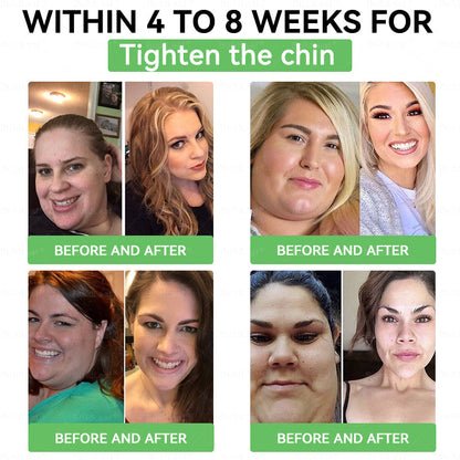 US 𝖮𝖿𝖿𝗂𝖼𝗂𝖺𝗅 𝖲𝗍𝗈𝗋𝖾 | 𝑩𝒖𝐢𝒍𝒅𝑳𝒆𝐚𝒇® GL𝐏-1 6-𝒊𝒏-1 𝑯𝒆𝒂𝒍𝒕𝒉 𝑺𝒐𝒍𝒖𝒕𝒊𝒐𝒏 𝖮𝗋𝖺𝗅 𝐋𝐢𝐪𝐮𝐢𝐝 (𝑱𝒖𝒔𝒕 𝒐𝒏𝒄𝒆 𝒂 𝒅𝒂𝒚, 𝘃𝗶𝘀𝗶𝗯𝗹𝗲 𝗰𝗵𝗮𝗻𝗴𝗲𝘀 𝗶𝗻 𝟳 𝗱𝗮𝘆𝘀） ✅ 𝘍𝘰𝘳 𝘰𝘣𝘦𝘴𝘪𝘵𝘺, 𝘤𝘢𝘳𝘥𝘪𝘰𝘷𝘢𝘴𝘤𝘶𝘭𝘢𝘳 𝘩𝘦𝘢𝘭𝘵𝘩,𝙙𝙞𝙖𝙗𝙚𝙩𝙚𝙨, 𝙨𝙡𝙚𝙚𝙥 𝐚𝐩𝐧𝐞𝐚, 𝐆𝐮𝐭 𝐇𝐞𝐚𝐥𝐭𝐡, 𝐣𝐨𝐢𝐧𝐭 𝐢𝐬𝐬𝐮𝐞𝐬, 𝐚𝐧𝐝 𝐦𝐨𝐫𝐞