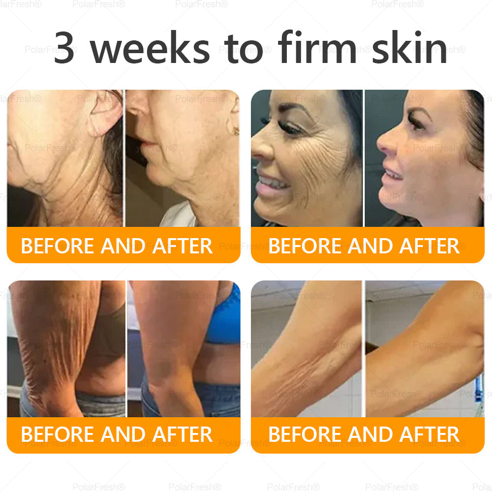 🗽Made & Shipped from USA | Clinically Proven: PolarFresh® Bee Venom Comprehensive Cream with bee venom peptides, botulinum toxin, hyaluronic acid, and collagen💧. Targets wrinkles, fine lines, sagging, stretch marks, dark spots and more