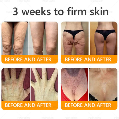 🗽Made & Shipped from USA | Clinically Proven: PolarFresh® Bee Venom Comprehensive Cream with bee venom peptides, botulinum toxin, hyaluronic acid, and collagen💧. Targets wrinkles, fine lines, sagging, stretch marks, dark spots and more