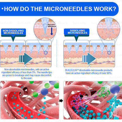 Official Store | BuildLeaf® SMGT-GLP-1 Nano Microneedle Patch with Collagen & Matrixyl 3000 丨Obesity,Cardiovascular Diseas, Diabetes, Sleep Apnea, Joint Problems and More
